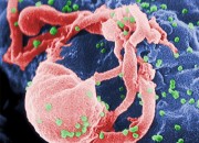 Scanning electron micrograph of HIV-1 budding from cultured lymphocyte.